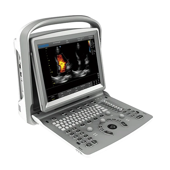 Chison ECO 6 Portable Ultrasound Machine