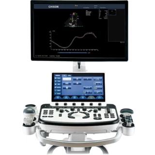 Chison XBit 90 Ultrasound Machine