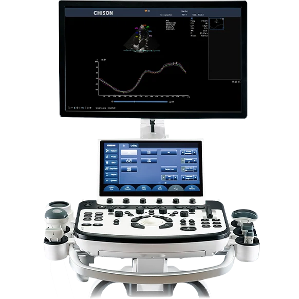 Chison XBit 90 Ultrasound Machine