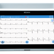 Edan iSE Series ECG Machine