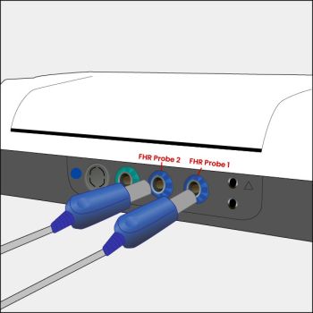 GT-1300 Quick Guide Illustrations_FHR Probe 2 & FHR Probe 1