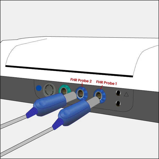 GT-1300 Quick Guide Illustrations_FHR Probe 2 & FHR Probe 1