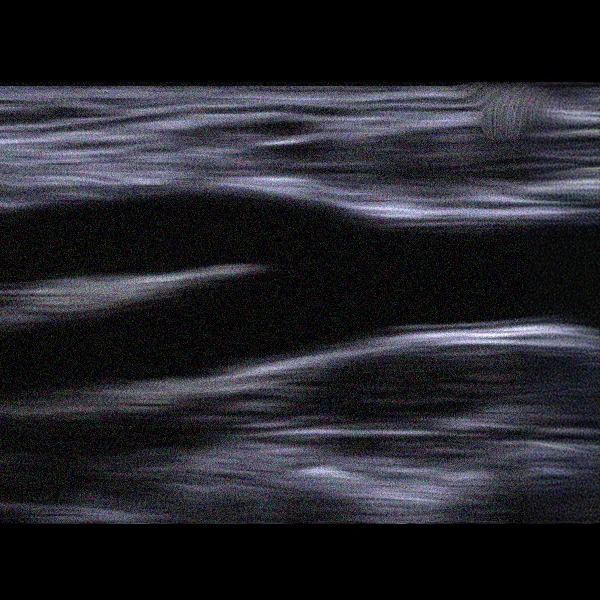 Icon-BMode-Ultrasound