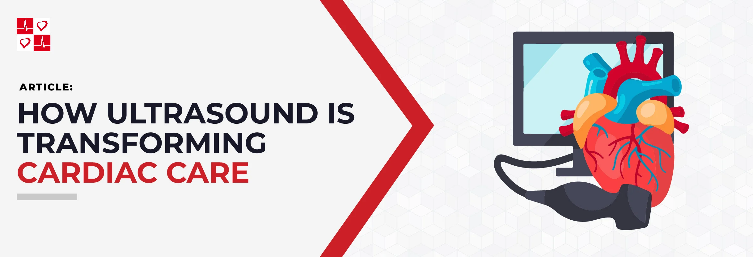 Ultrasound-Transforming-Cardiac-Care_Title-Graphic