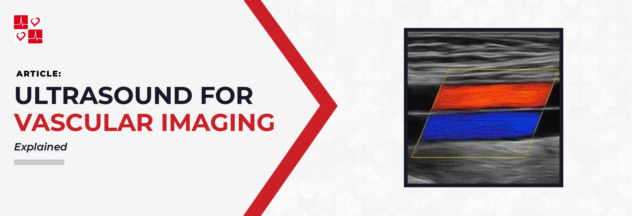Ultrasound-for-Vascular-Imaging_Graphic