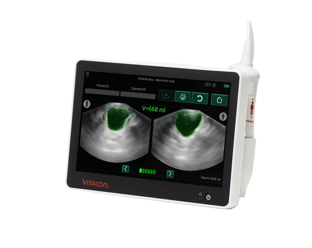Vitacon eVue Bladder Scanner