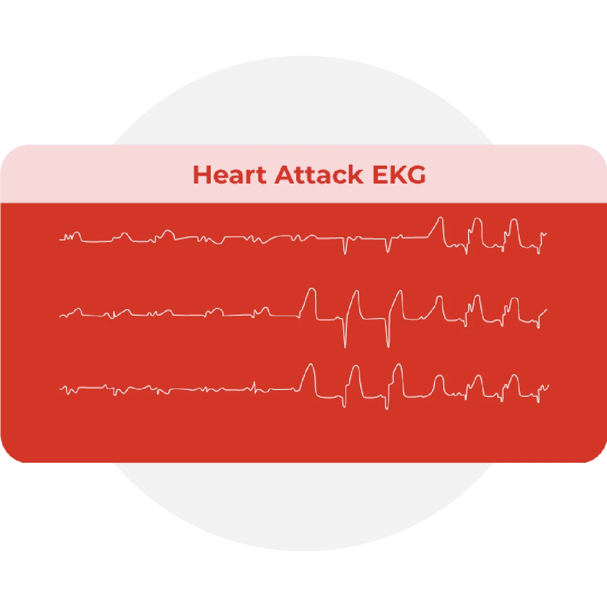 Icons_Past Heart Attacks