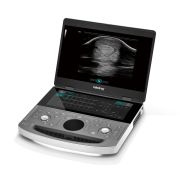 Mindray Vetus EQ – Equine Ultrasound Image System