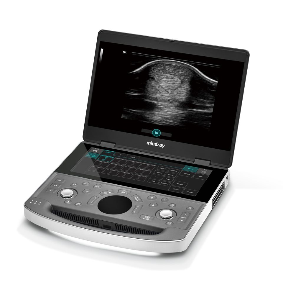 Mindray Vetus EQ – Equine Ultrasound Image System