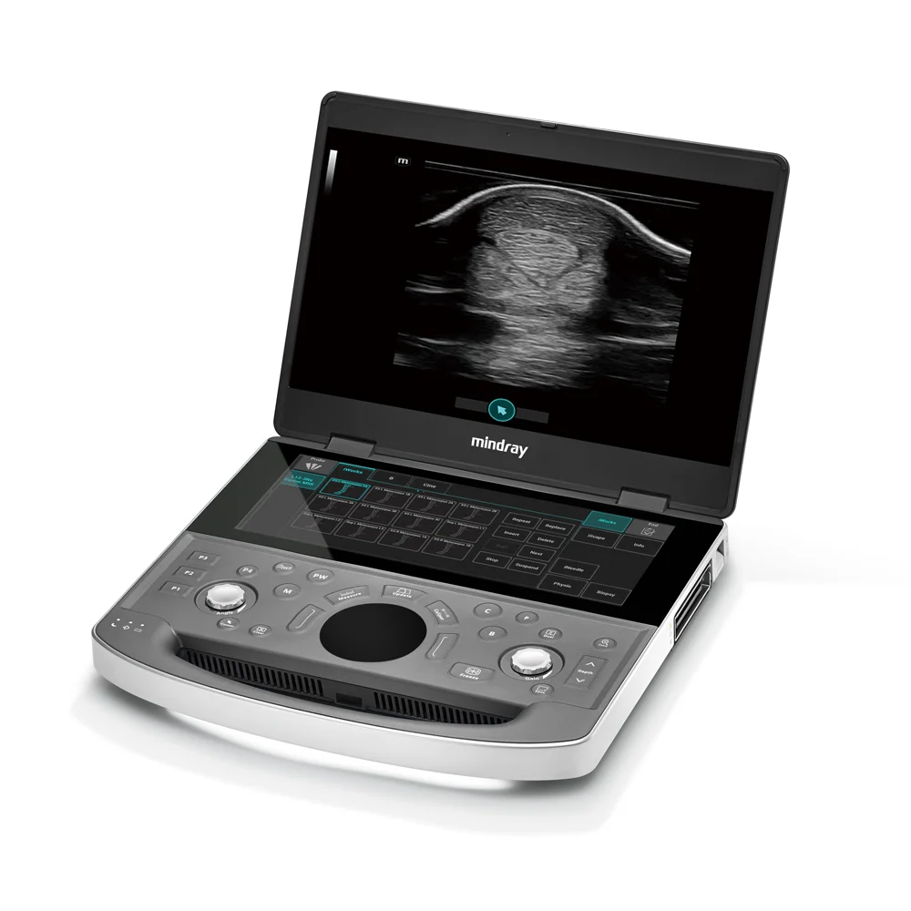 Mindray Vetus EQ - Equine Ultrasound Image System