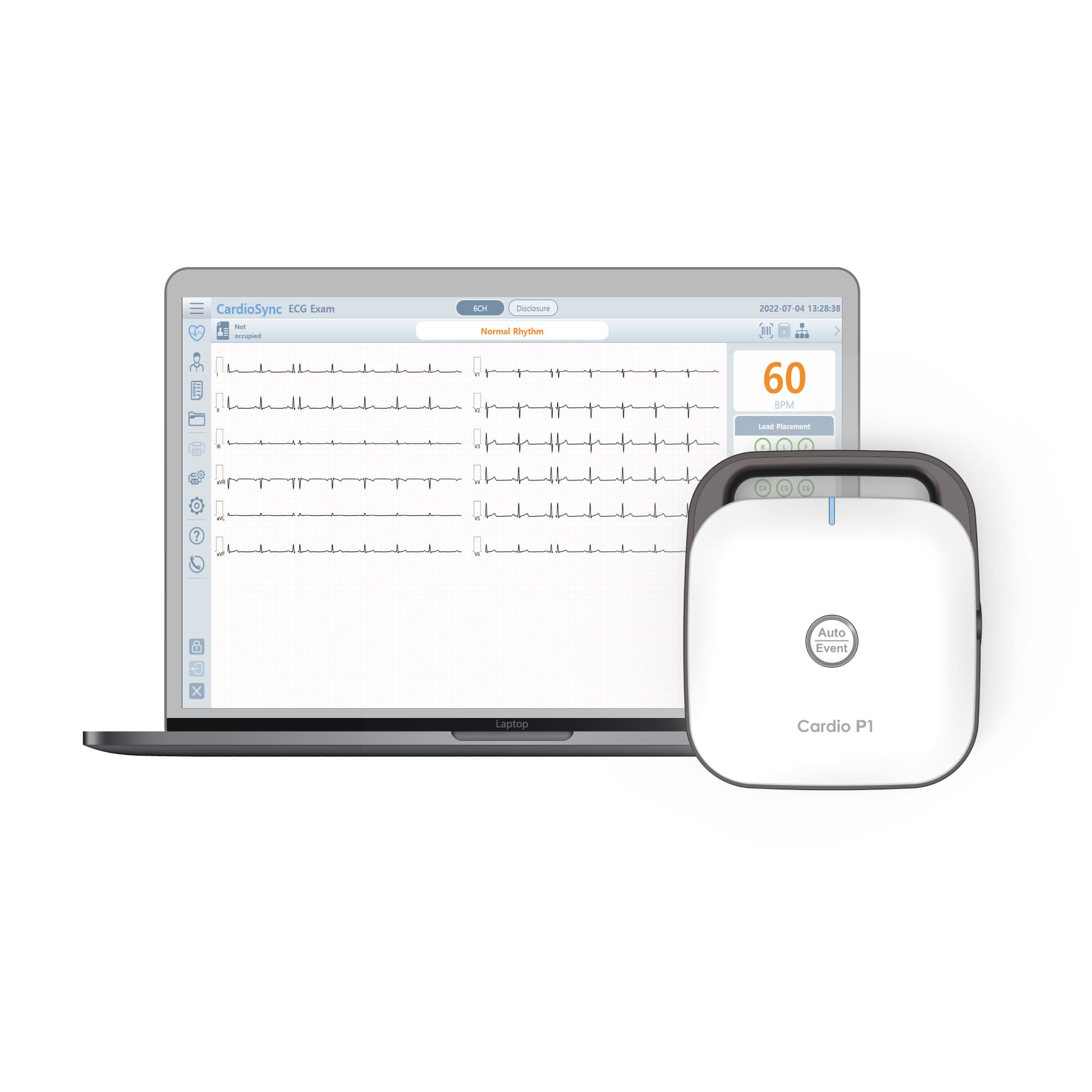Bionet Cardio P1 PC-based 12-Lead Resting ECG - CardiacDirect