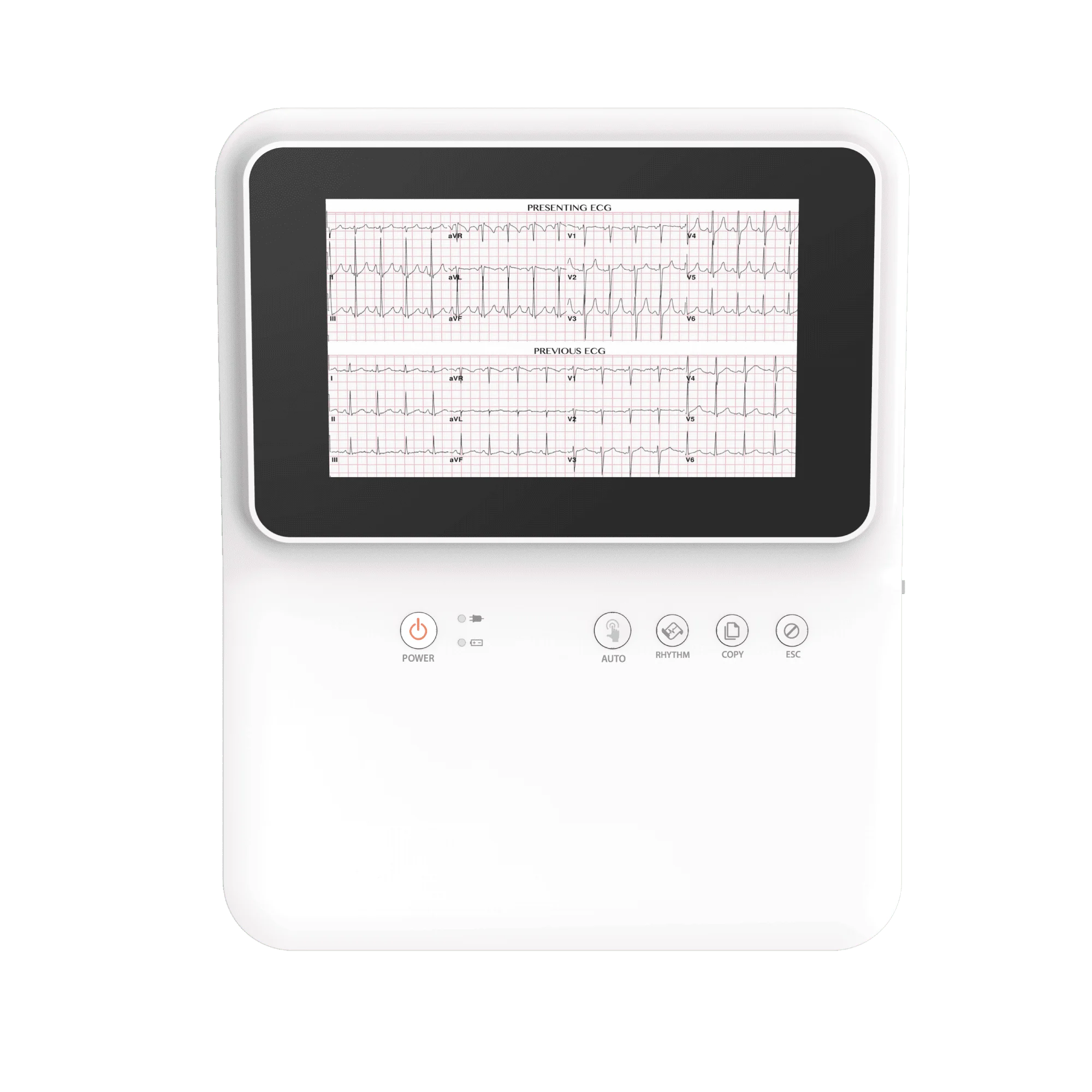 CardioTech GT-50 12-Channel Resting ECG Machine