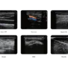 Edan Nano L12 EXP Diagnostic Ultrasound System
