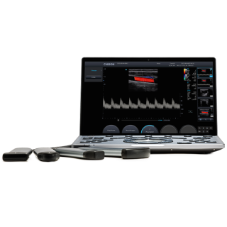 Chison SonoAir 60 Ultrasound Machine